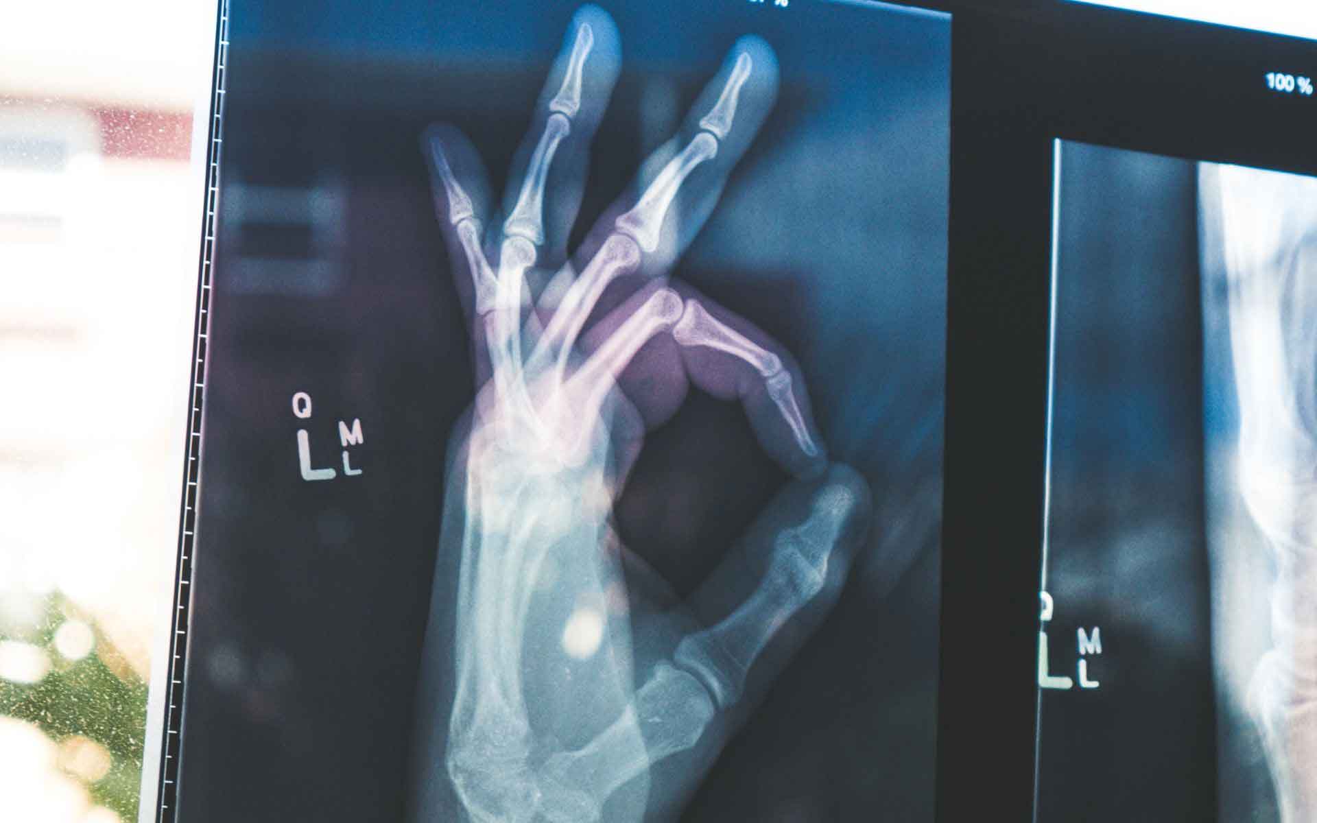 hand-xray xray of a hand making the OK sign